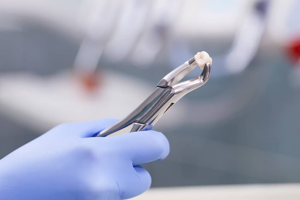 Oral Surgery at Fioritto Family Dental
