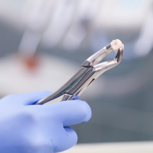 Oral Surgery at Fioritto Family Dental