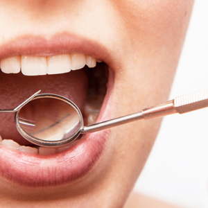 Periodontics at Fioritto Family Dental