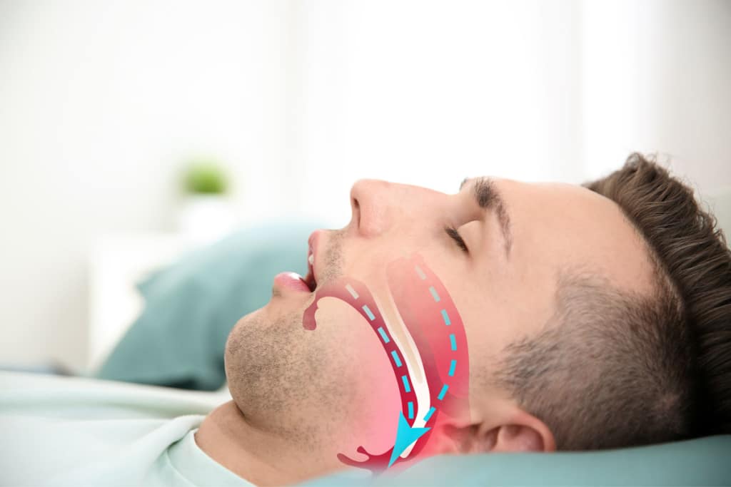 Fioritto Family Dental Sleep Support