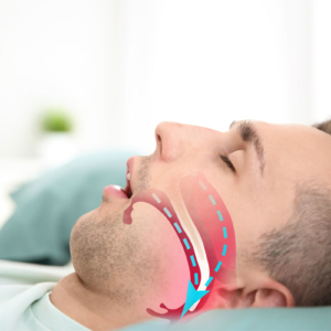 Fioritto Family Dental Sleep Support
