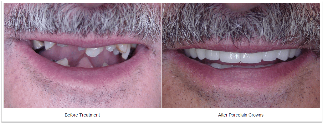 smile makeover Fioritto Family Dental