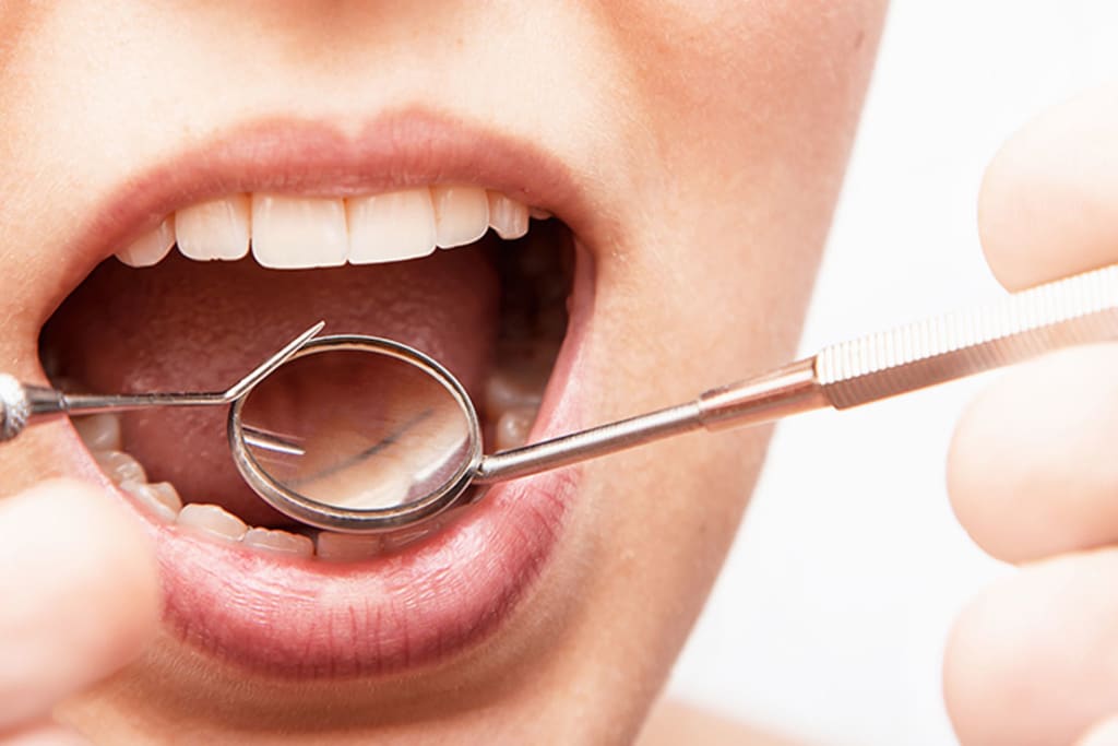 Periodontics at Fioritto Family Dental