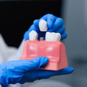 Dental Implant Specialist Near Me