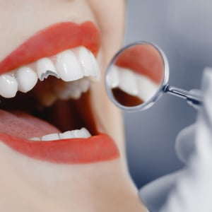 cracked tooth dentist