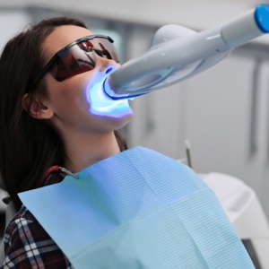 teeth whitening