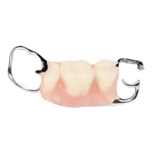 partial denture