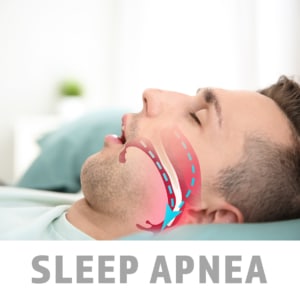 Sleep Apnea and Dentistry
