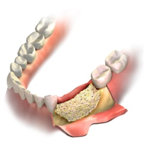 Dental Concord OH