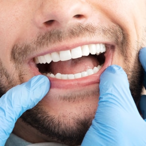 Dentist Mentor OH