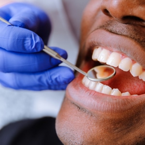 dental exam