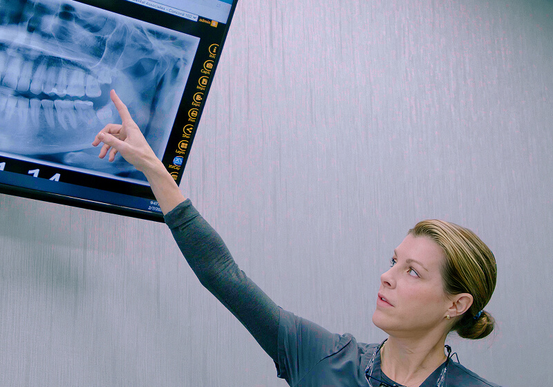 A staff member at Fioritto Family Dental pointing and a screen displaying digital x-rays of teeth. 