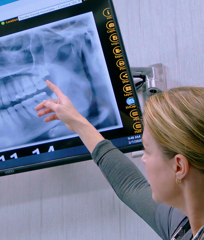 A staff member at Fioritto Family Dental pointing at a computer screen showing digital x-rays in the exam room in OH.